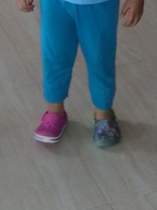 Alba is wearing two different shoes